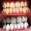 tandblegning Aktivt kul-strips