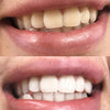 Hvide og lyse tænder gennem Diamond tandblegning