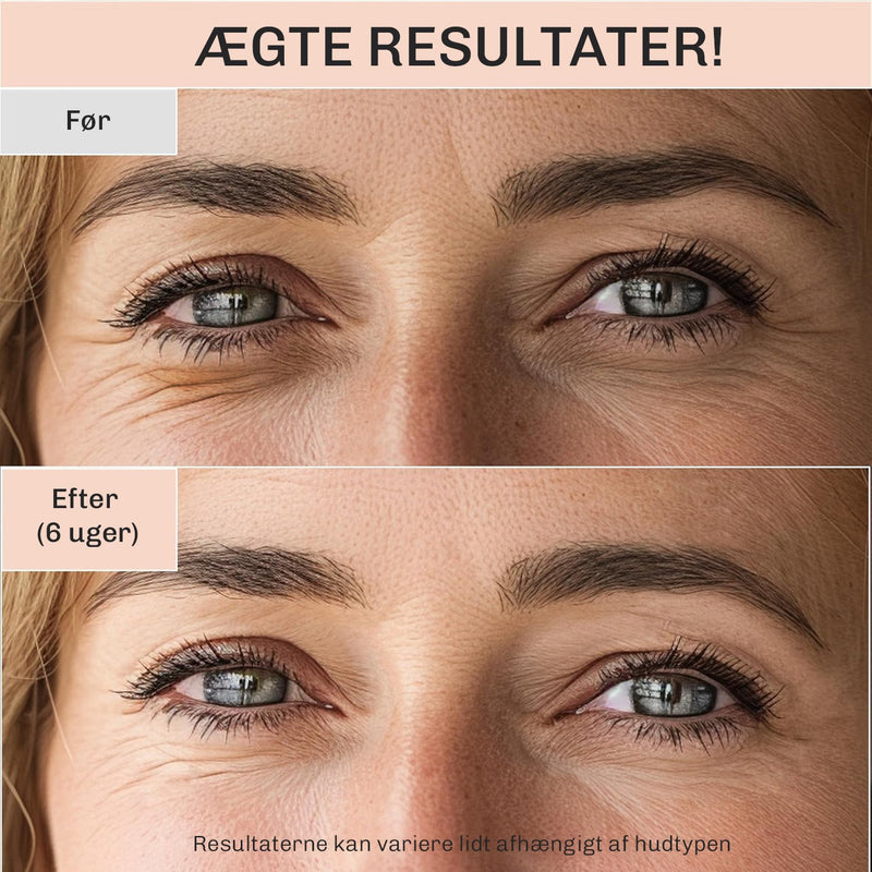 Øjencreme AgeRepair 7
