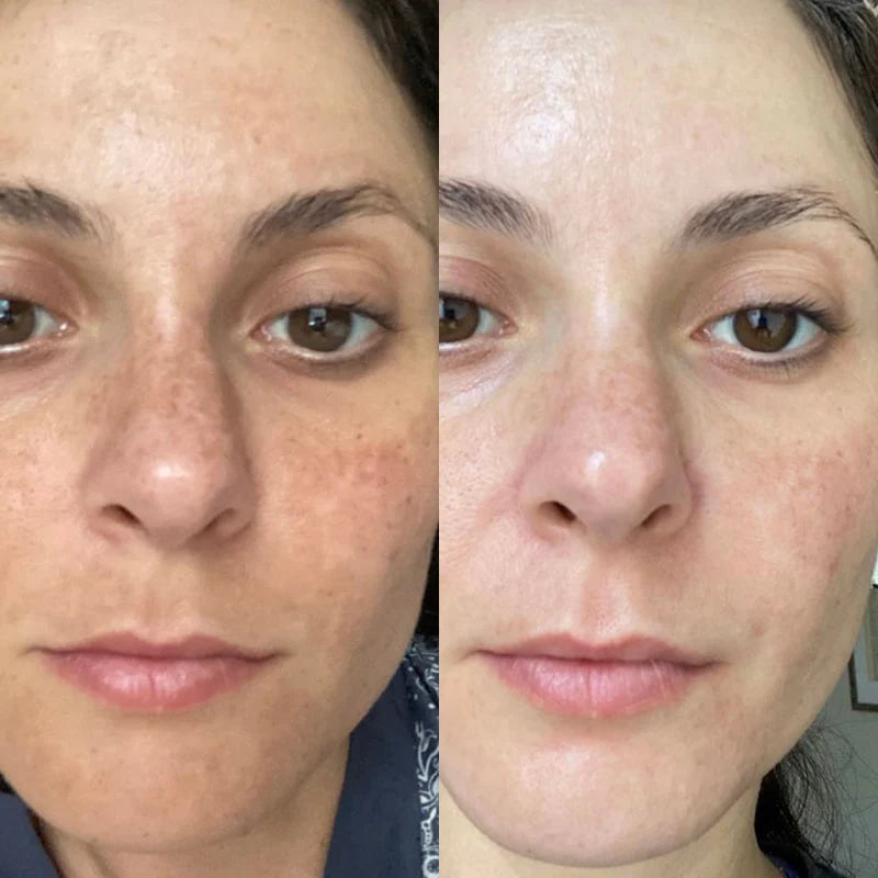 Kollagen Lifting Creme