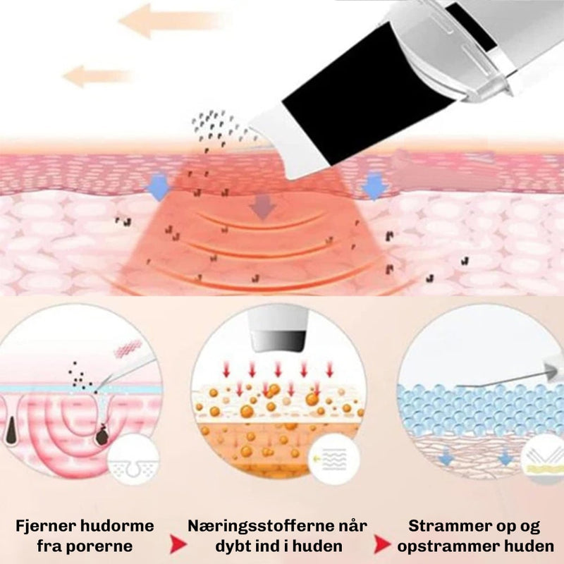 Ultralyd Peeling DermaGlow 5