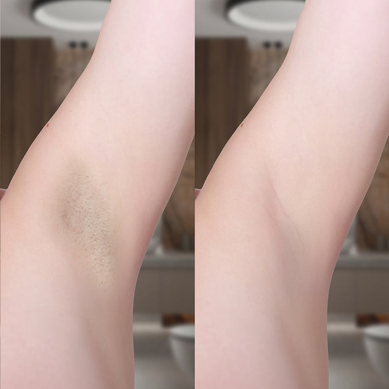 IPL Hårfjerner Lumi