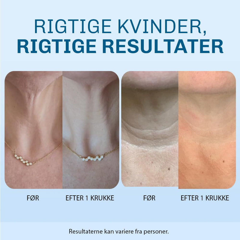 Halsfalten Lifting Creme