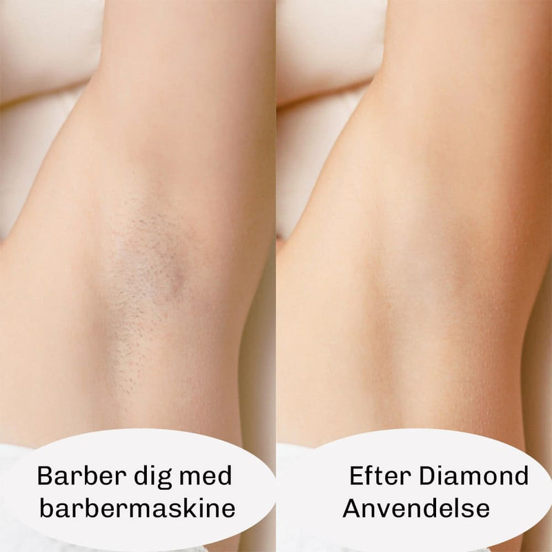 IPL Hårfjerner PERFORMANCE 2.0