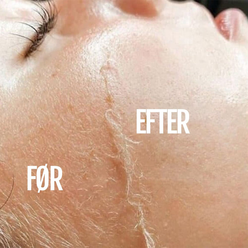 Ultralyd Hårfjerner SILKYFLASH+