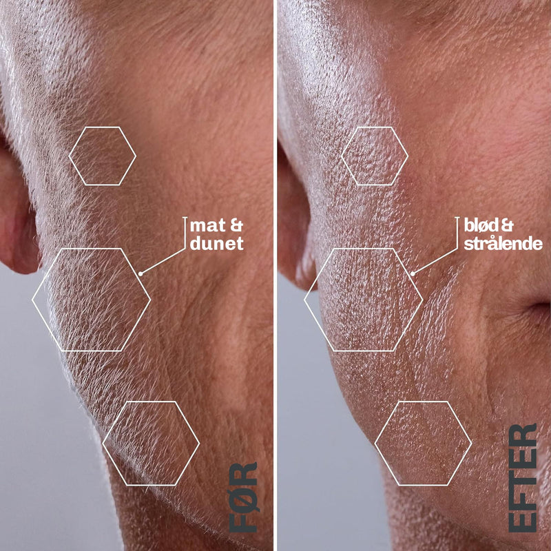 Ultralyd Hårfjerner SILKYFLASH+